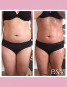bioslimming-beauty-more