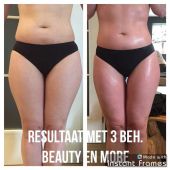 bioslimming-lisette