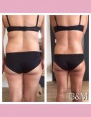 bioslimming-wrap-beauty-more